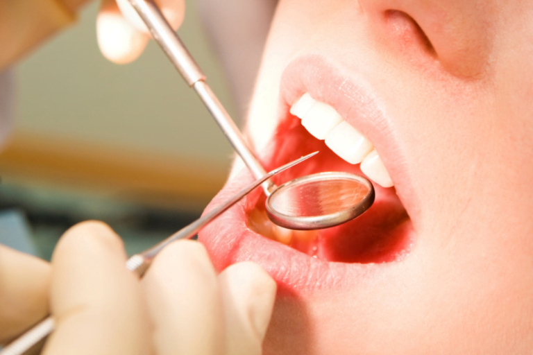 How Do Basic and Major Dental Care Services Differ?