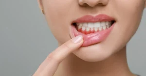 Essential Gum Disease Self-Care Tips